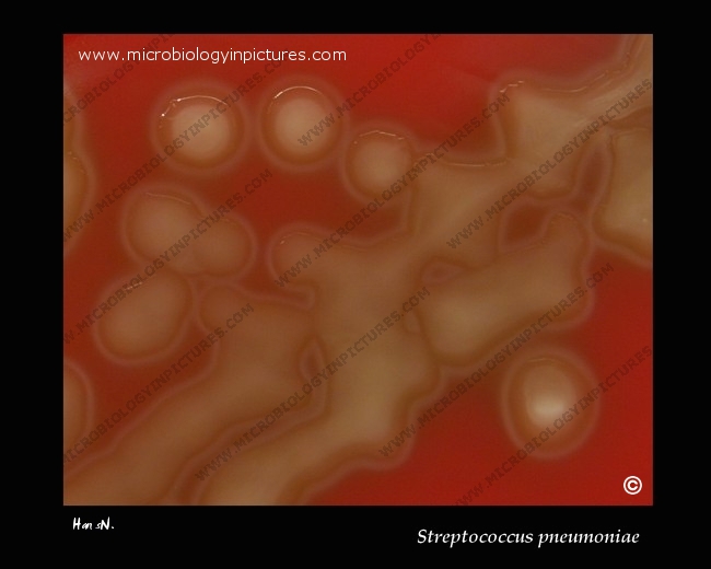 S.pneumoniae alpha-hemolysis